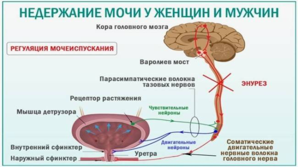 Что такое недержание мочи, как его контролировать