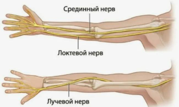 Невралгия или синдром сдавления нерва